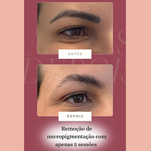 prova-social-laser-discovery-pico-05