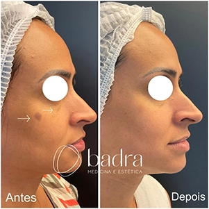 prova-social-laser-discovery-pico-06