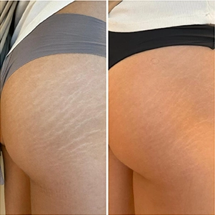 prova-social-ultraformer-mpt-04