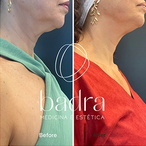 prova-social-ultraformer-mpt-06