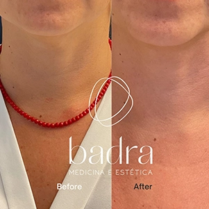 prova-social-ultraformer-mpt-07