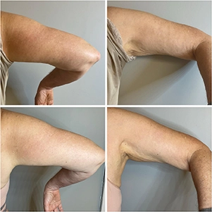 prova-social-ultraformer-mpt-08