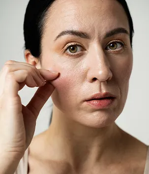 Pele ressecada, áspera, desidratada - Badra Medicina e Estética