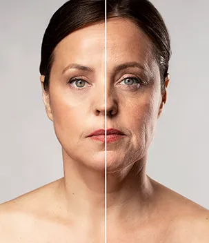 Rejuvenescimento - Badra Medicina e Estética